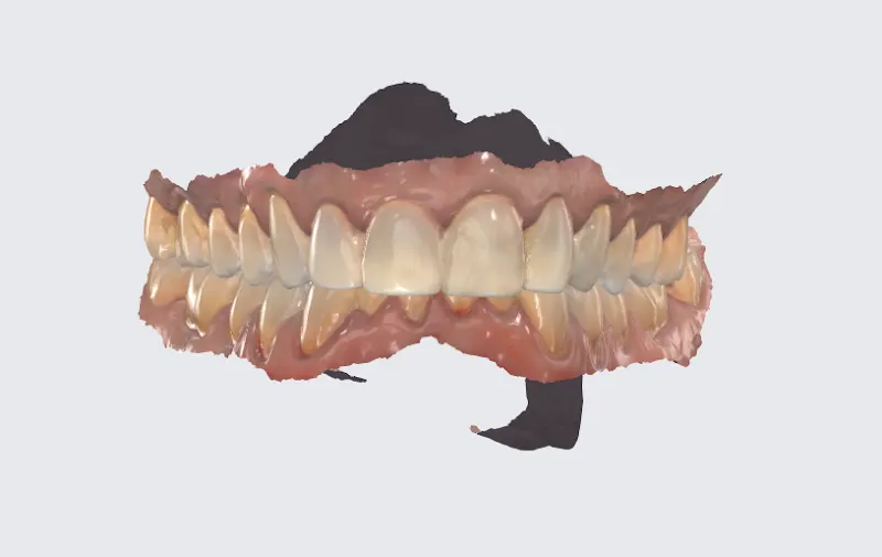 Clínica Dental Dr. Estévez - Madrid