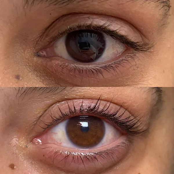 Carmen Gómez - Tratamientos Faciales a Domicilio, Limpieza facial, Dermapen, flacidez, arrugas, manchas - Madrid