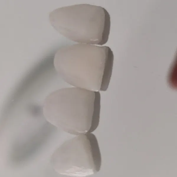 CLÍNICA DENTAL LOS PINOS - Dentista en Madrid - foto 2